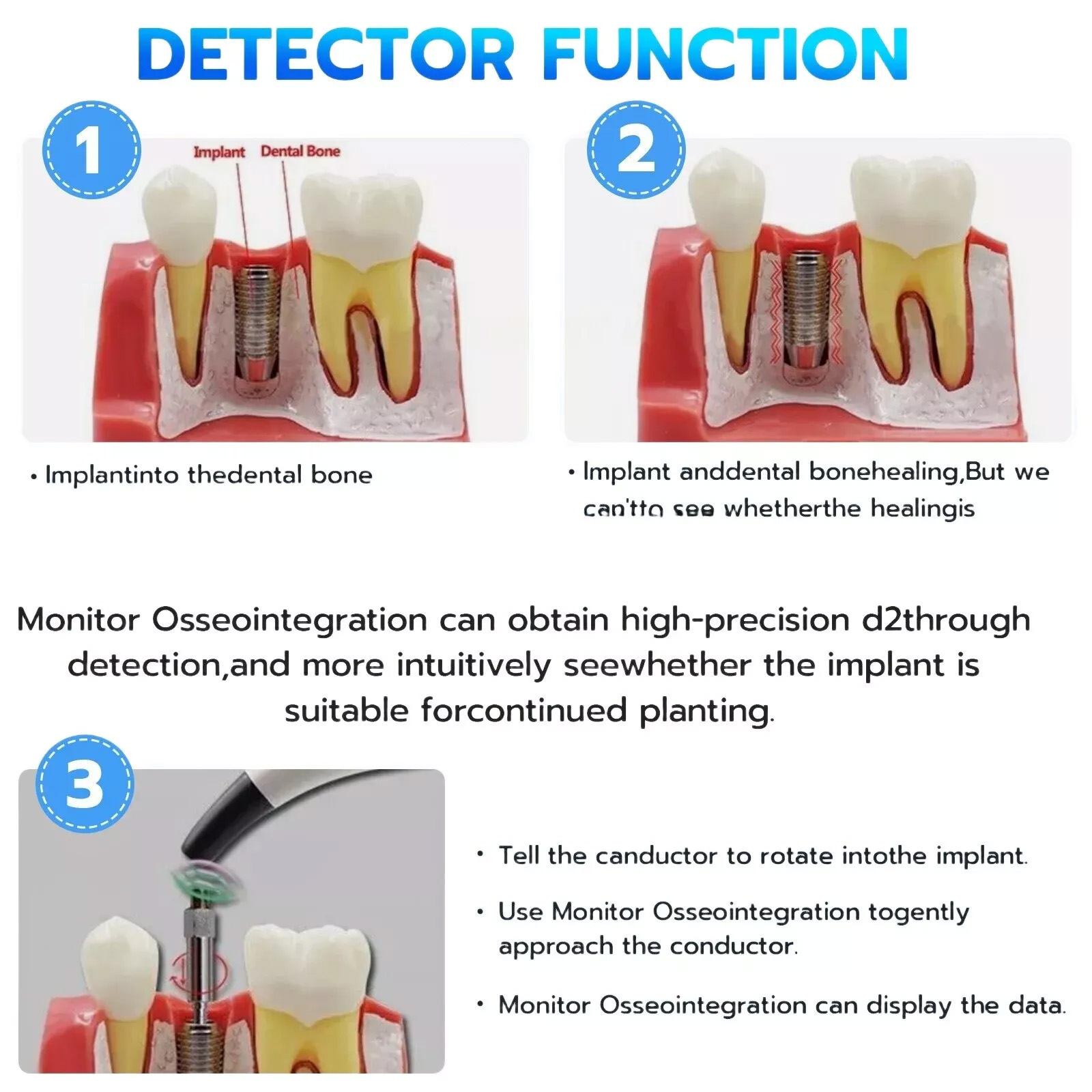 Denta Implant Stability Tester Implant Osseointegration Monitor ISQ Meter